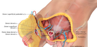 Johns Hopkins performs first total penis and scrotum transplant in the world