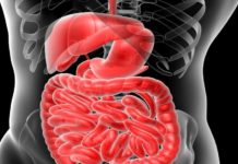Links between eating red meat and distal colon cancer in women
