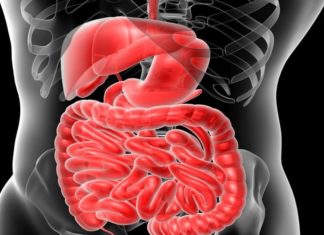 Links between eating red meat and distal colon cancer in women