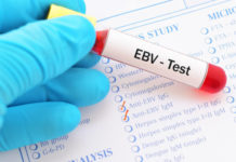 ‘Mono’ virus linked to 7 serious diseases