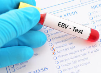 ‘Mono’ virus linked to 7 serious diseases