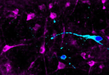 NEURONS DERIVED FROM SUPER-OBESE PEOPLE RESPOND DIFFERENTLY TO APPETITE HORMONE