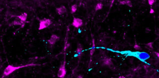 NEURONS DERIVED FROM SUPER-OBESE PEOPLE RESPOND DIFFERENTLY TO APPETITE HORMONE