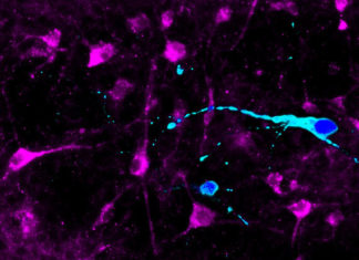 NEURONS DERIVED FROM SUPER-OBESE PEOPLE RESPOND DIFFERENTLY TO APPETITE HORMONE
