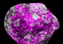 Odd one out: Protein goes against the family to prevent cancer