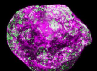 Odd one out: Protein goes against the family to prevent cancer
