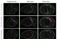Pathway to Spatial Recognition