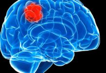 Possible Novel Method for Stopping Untreatable Pediatric Brain Cancers