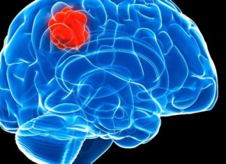 Possible Novel Method for Stopping Untreatable Pediatric Brain Cancers