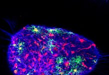 Researchers Fix Genetic Risk Factor of Alzheimer’s in Human Brain Cells