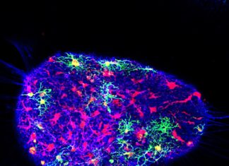 Researchers Fix Genetic Risk Factor of Alzheimer’s in Human Brain Cells