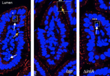 Researchers find alternate path for Listeria to sicken people