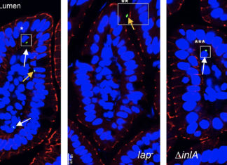 Researchers find alternate path for Listeria to sicken people