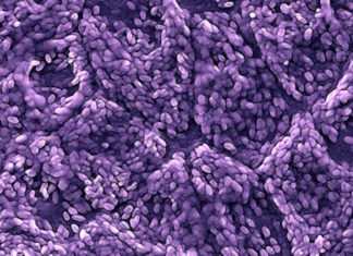 Researchers test stem cell-based retinal implant for common cause of vision loss