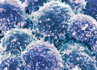 Synthetic cancer indicator: An artificial mole as an early warning system