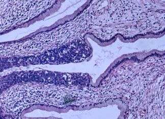 There’s a better way to screen for cervical cancer