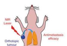 Thermo-chemotherapy combo eradicates primary and metastatic tumors in mice