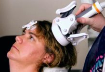 Three Minute Version of Brain Stimulation Therapy Effective for Hard to Treat Depression