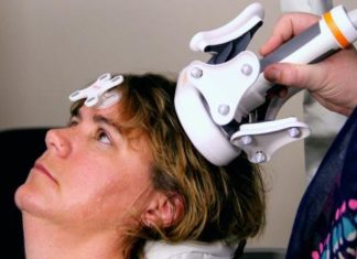 Three Minute Version of Brain Stimulation Therapy Effective for Hard to Treat Depression
