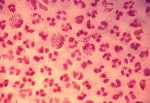 U.K. man found to have gonorrhea resistant to conventional treatments