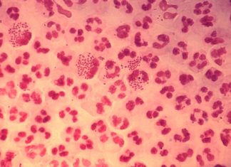 U.K. man found to have gonorrhea resistant to conventional treatments