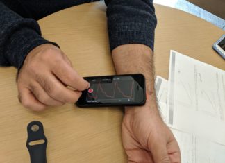 Using AI to Detect Heart Disease