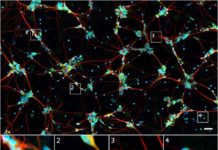 Teaching Computers How to Analyze Brain Cells