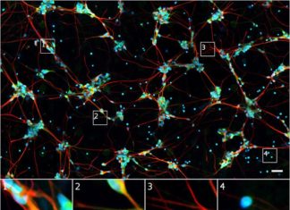 Teaching Computers How to Analyze Brain Cells