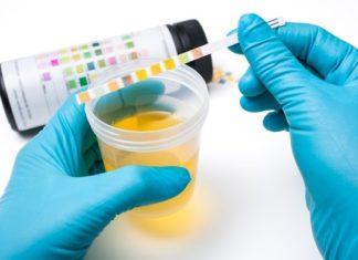 Japan to trial ‘world’s first urine test’ to spot cancer