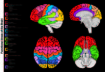 A neuroimaging study reveals brain areas not commonly associated with science learning become active when people complete physics problems