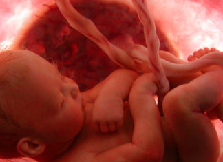 A new study reveals, in combination to genetics and environmental factors, placenta health during fetal development may play a role in schizophrenia