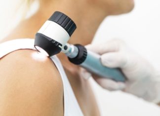 AI is better than dermatologists at diagnosing skin cancer
