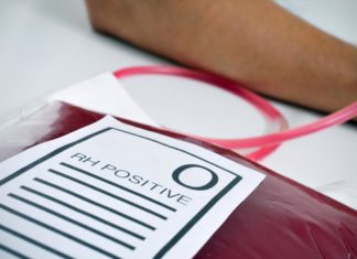 Blood type O patients may have higher risk of death from severe trauma