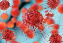 Dilemma for cancer patients as life-saving meds are tied to vision loss