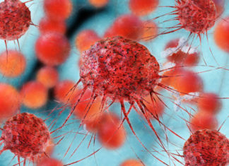 Dilemma for cancer patients as life-saving meds are tied to vision loss