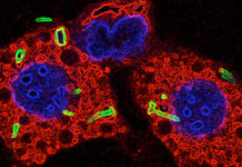 Discovered Link Between Tuberculosis and Parkinson’s Disease