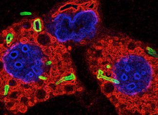 Discovered Link Between Tuberculosis and Parkinson’s Disease