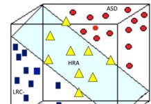EEG signals accurately predict autism as early as 3 months of age