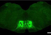 Frontal Lobe Implicated in Chronic Pain