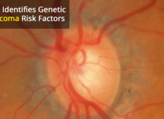 Genetic Variants That May Predict Glaucoma Risk Identified