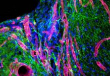 Mice regrow brain tissue after stroke with bioengineered gel