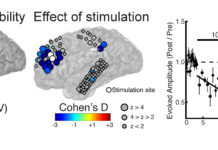 Personalizing Therapeutic Brain Stimulation