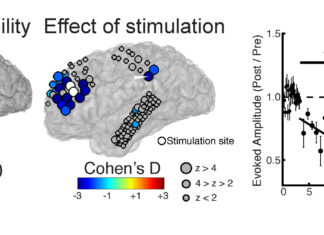 Personalizing Therapeutic Brain Stimulation
