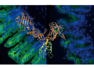 Research may help combat the deadly gastrointestinal infection Clostridium difficile
