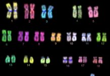 Researchers report fetuses with a rare chromosomal aberration have a 20% increased risk of being diagnosed with a developmental disorder