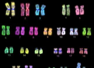Researchers report fetuses with a rare chromosomal aberration have a 20% increased risk of being diagnosed with a developmental disorder