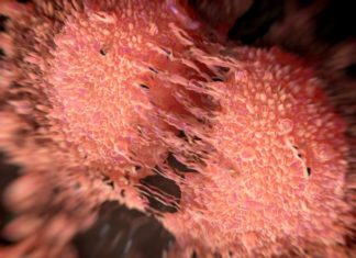 Scientists identify novel cellular mechanism that can lead to cancer metastasis