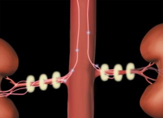 Surgery involving ultrasound energy found to treat high blood pressure