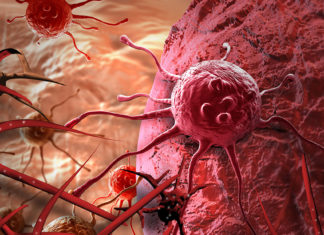 Tiny Particles Could Help Fight Brain Cancer