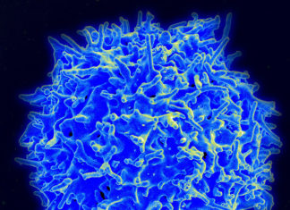 Two teams independently come up with a way to avert CRS in CAR T-cell therapies